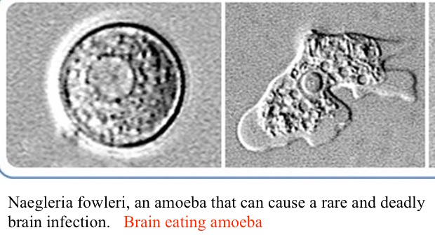 brain-eating-amoeba-jpg.jpg
